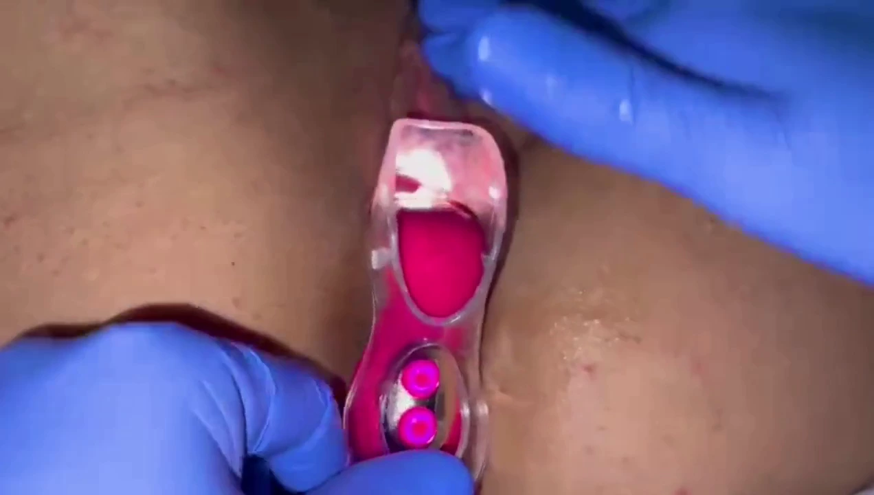 Vagina and Cervix Close Up Examination